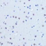 Immunohistochemistry - Anti-PIAS2 Antibody (A14883) - Antibodies.com