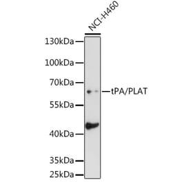 Western Blot - Anti-Tissue Plasminogen Activator Antibody (A14884) - Antibodies.com
