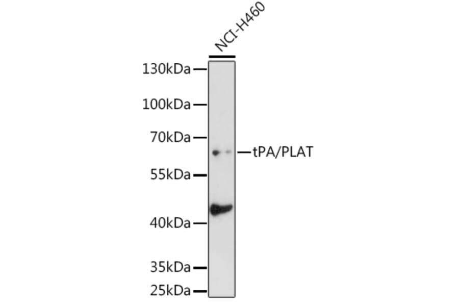 Western Blot - Anti-Tissue Plasminogen Activator Antibody (A14884) - Antibodies.com