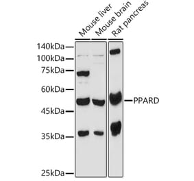 Western Blot - Anti-PPAR delta Antibody (A14885) - Antibodies.com