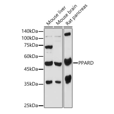 Western Blot - Anti-PPAR delta Antibody (A14885) - Antibodies.com