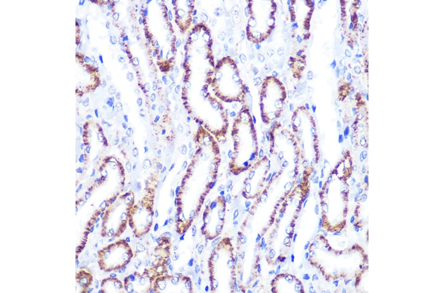Immunohistochemistry - Anti-Smad4 Antibody (A14886) - Antibodies.com