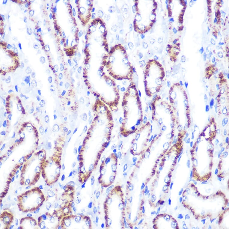 Immunohistochemistry - Anti-Smad4 Antibody (A14886) - Antibodies.com