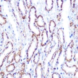 Immunohistochemistry - Anti-Smad4 Antibody (A14886) - Antibodies.com