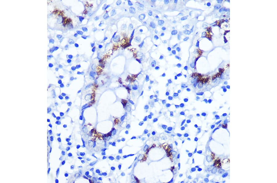 Immunohistochemistry - Anti-Smad4 Antibody (A14886) - Antibodies.com