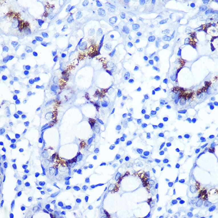 Immunohistochemistry - Anti-Smad4 Antibody (A14886) - Antibodies.com