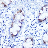 Immunohistochemistry - Anti-Smad4 Antibody (A14886) - Antibodies.com