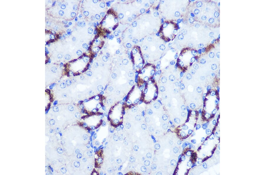 Immunohistochemistry - Anti-Smad4 Antibody (A14886) - Antibodies.com