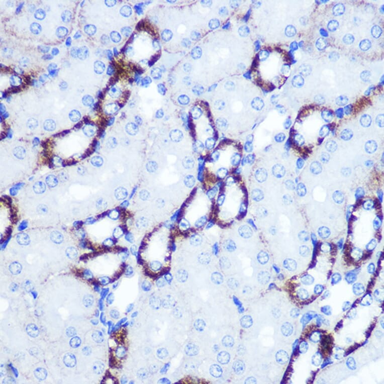 Immunohistochemistry - Anti-Smad4 Antibody (A14886) - Antibodies.com