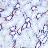 Immunohistochemistry - Anti-Smad4 Antibody (A14886) - Antibodies.com