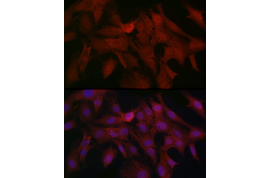 Immunofluorescence - Anti-Smad4 Antibody (A14886) - Antibodies.com