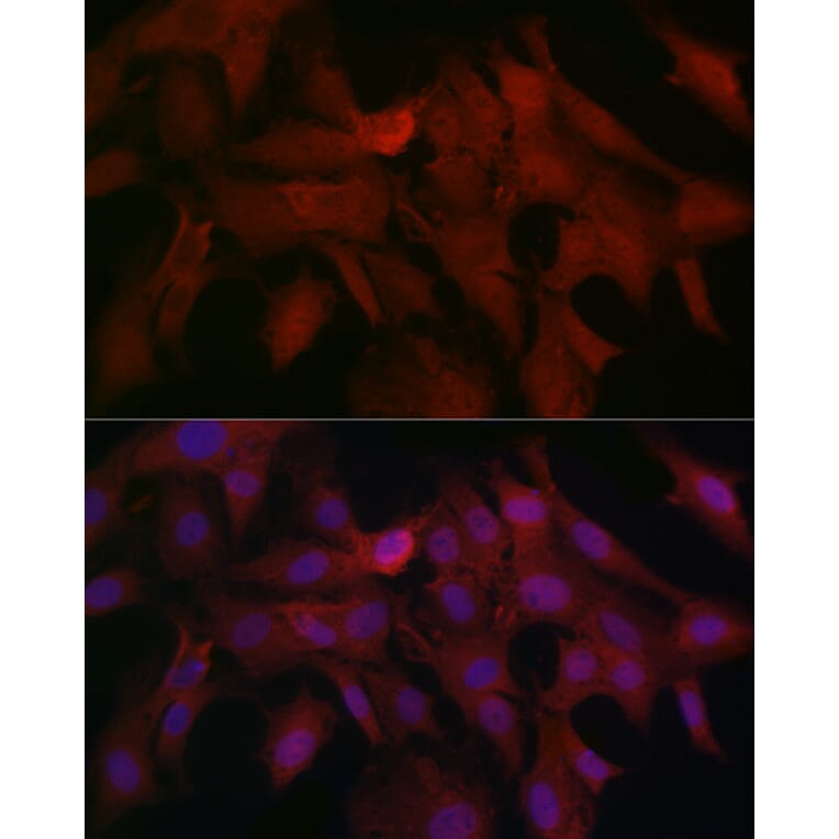 Immunofluorescence - Anti-Smad4 Antibody (A14886) - Antibodies.com