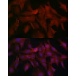 Immunofluorescence - Anti-Smad4 Antibody (A14886) - Antibodies.com