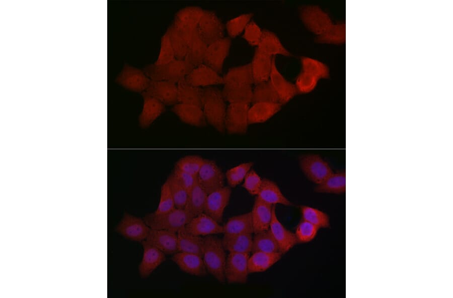 Immunofluorescence - Anti-Smad4 Antibody (A14886) - Antibodies.com