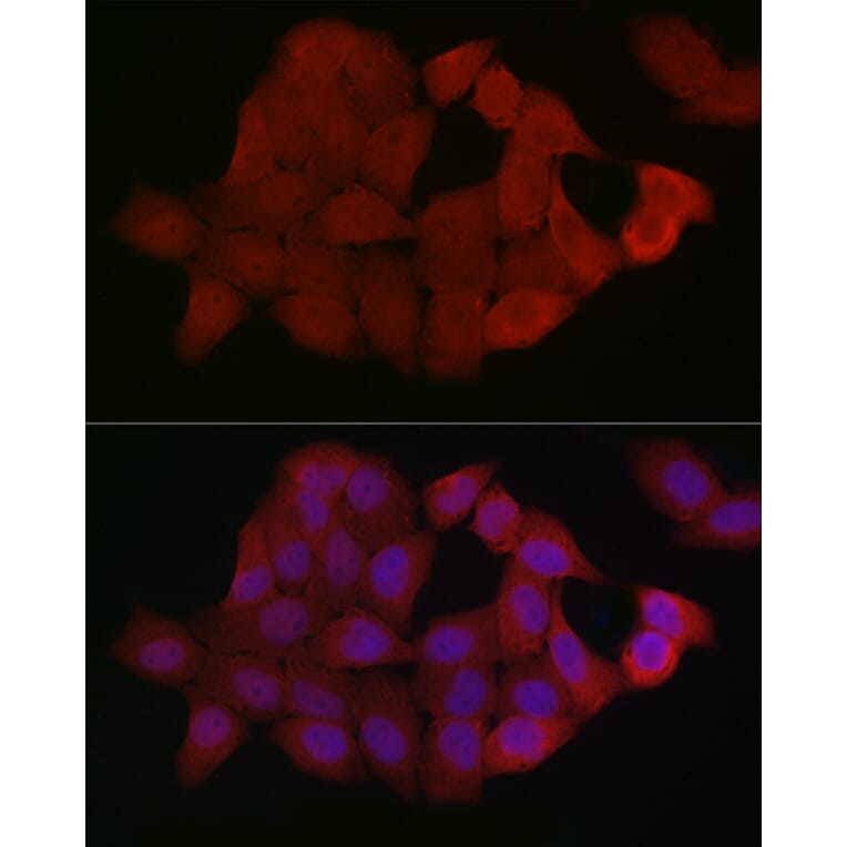 Immunofluorescence - Anti-Smad4 Antibody (A14886) - Antibodies.com