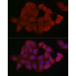 Immunofluorescence - Anti-Smad4 Antibody (A14886) - Antibodies.com