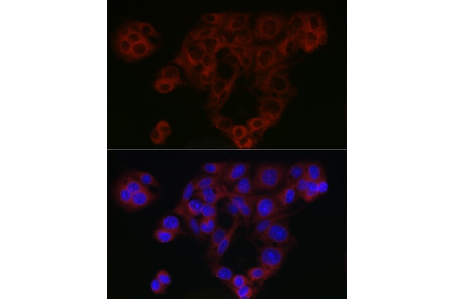 Immunofluorescence - Anti-Smad4 Antibody (A14886) - Antibodies.com