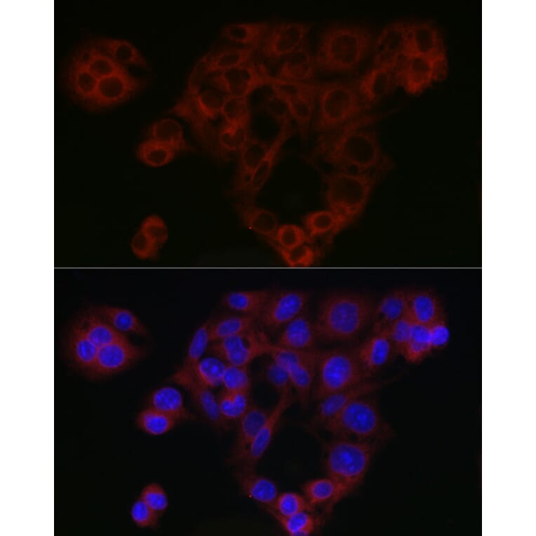 Immunofluorescence - Anti-Smad4 Antibody (A14886) - Antibodies.com