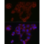 Immunofluorescence - Anti-Smad4 Antibody (A14886) - Antibodies.com