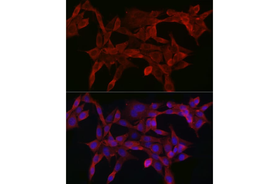 Immunofluorescence - Anti-Smad4 Antibody (A14886) - Antibodies.com