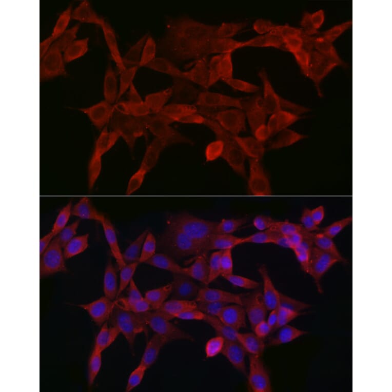 Immunofluorescence - Anti-Smad4 Antibody (A14886) - Antibodies.com