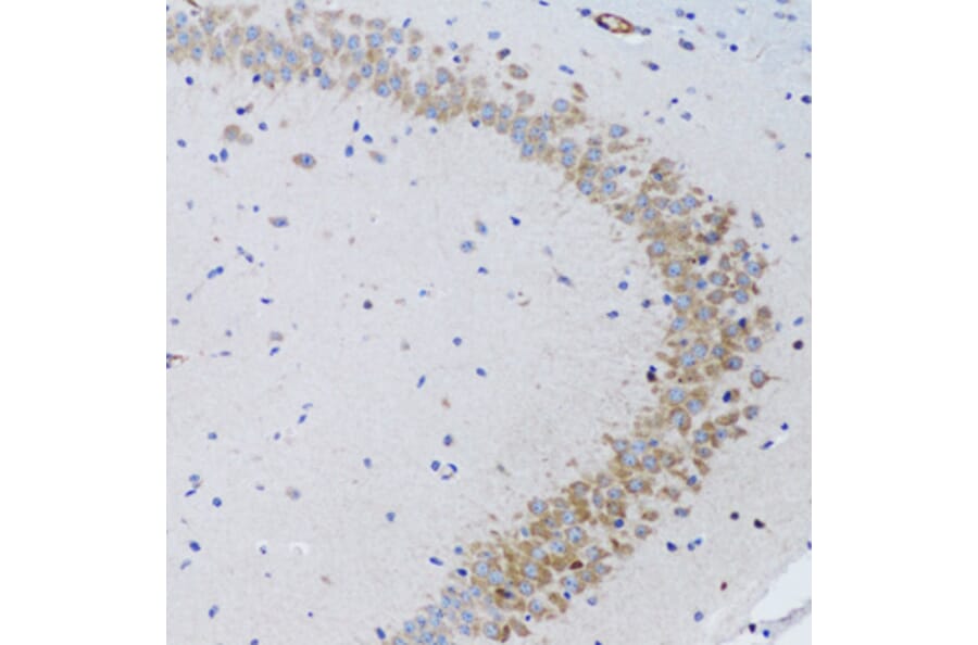 Immunohistochemistry - Anti-TWEAK Antibody (A14887) - Antibodies.com