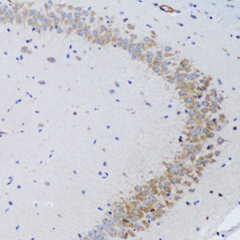 Immunohistochemistry - Anti-TWEAK Antibody (A14887) - Antibodies.com