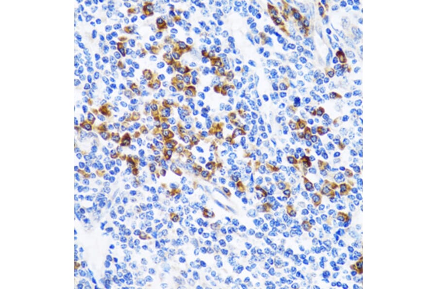 Immunohistochemistry - Anti-TWEAK Antibody (A14887) - Antibodies.com