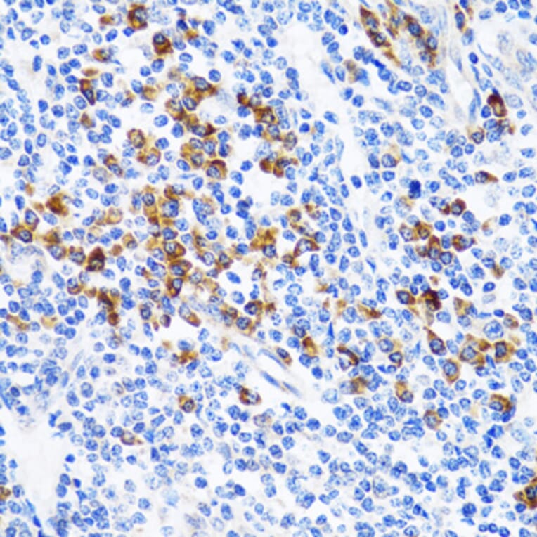 Immunohistochemistry - Anti-TWEAK Antibody (A14887) - Antibodies.com