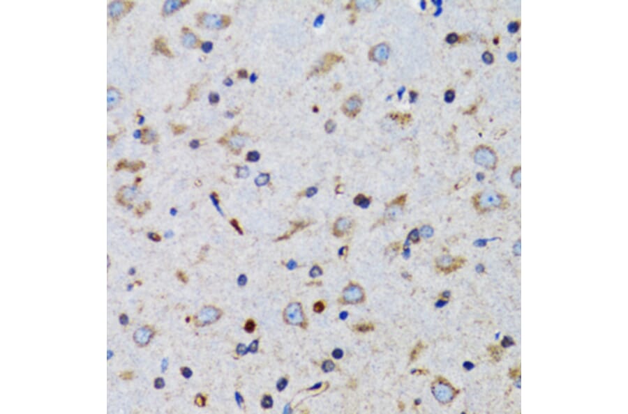 Immunohistochemistry - Anti-TWEAK Antibody (A14887) - Antibodies.com