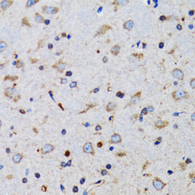 Immunohistochemistry - Anti-TWEAK Antibody (A14887) - Antibodies.com