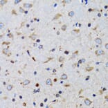 Immunohistochemistry - Anti-TWEAK Antibody (A14887) - Antibodies.com