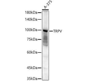 Western Blot - Anti-TRPV4 Antibody (A14888) - Antibodies.com