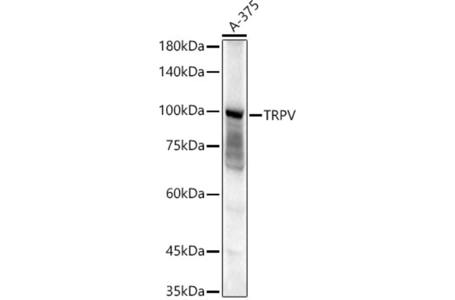 Western Blot - Anti-TRPV4 Antibody (A14888) - Antibodies.com