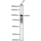 Western Blot - Anti-TRPV4 Antibody (A14888) - Antibodies.com