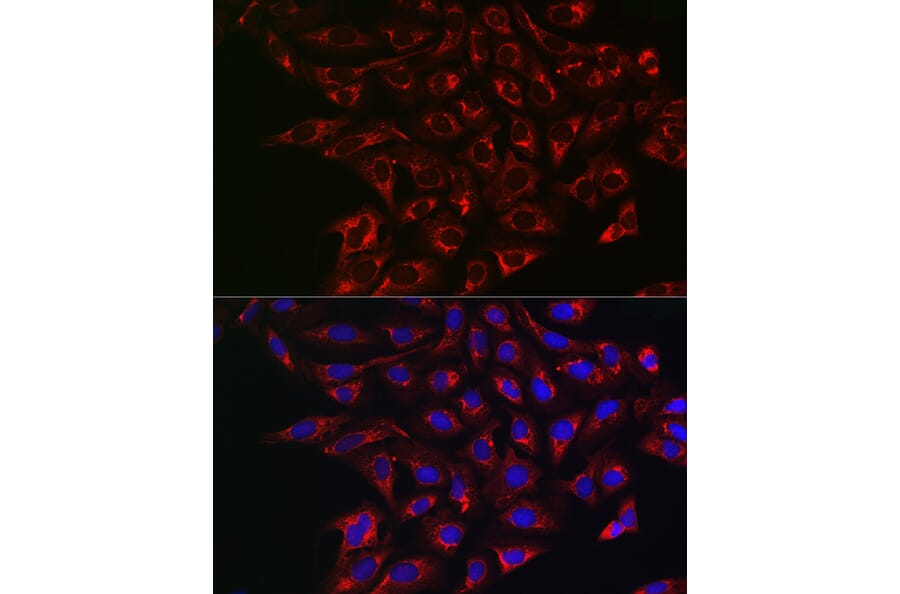 Anti-BCRP / ABCG2 Antibody (A14889) | Antibodies.com