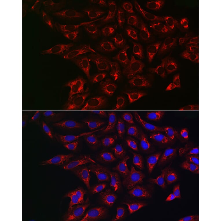 Immunofluorescence - Anti-BCRP/ABCG2 Antibody (A14889) - Antibodies.com