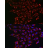 Immunofluorescence - Anti-BCRP/ABCG2 Antibody (A14889) - Antibodies.com