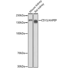 Western Blot - Anti-CD13 Antibody (A14890) - Antibodies.com