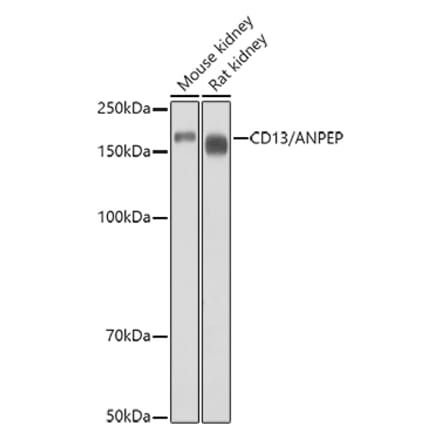 Western Blot - Anti-CD13 Antibody (A14890) - Antibodies.com