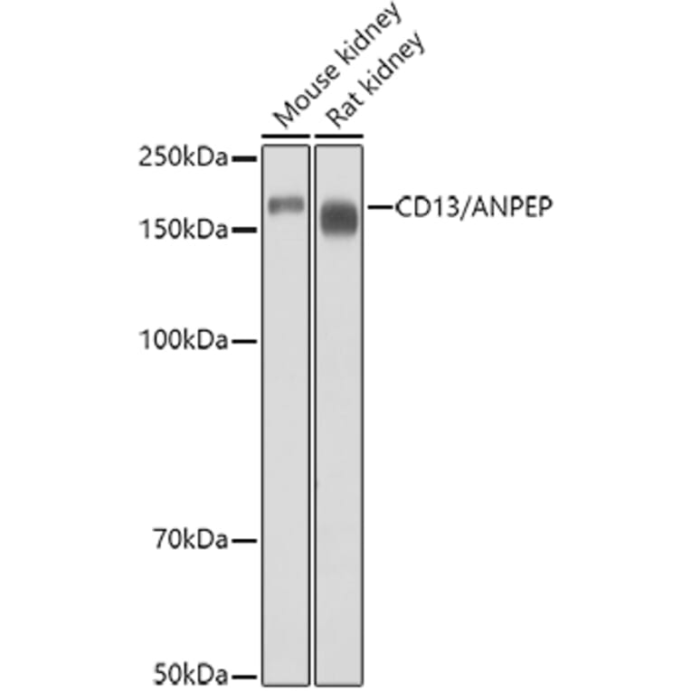 Western Blot - Anti-CD13 Antibody (A14890) - Antibodies.com