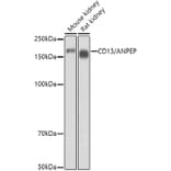 Western Blot - Anti-CD13 Antibody (A14890) - Antibodies.com