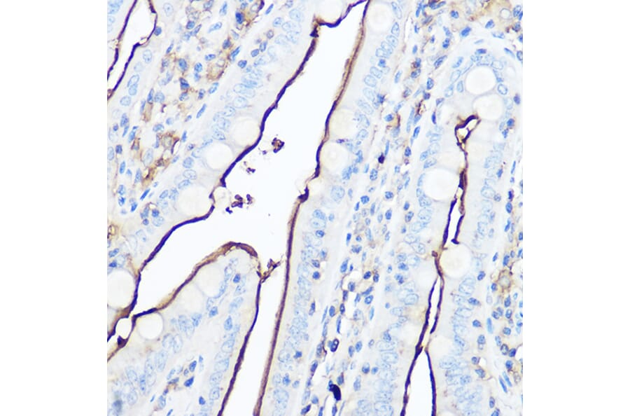Immunohistochemistry - Anti-CD13 Antibody (A14890) - Antibodies.com