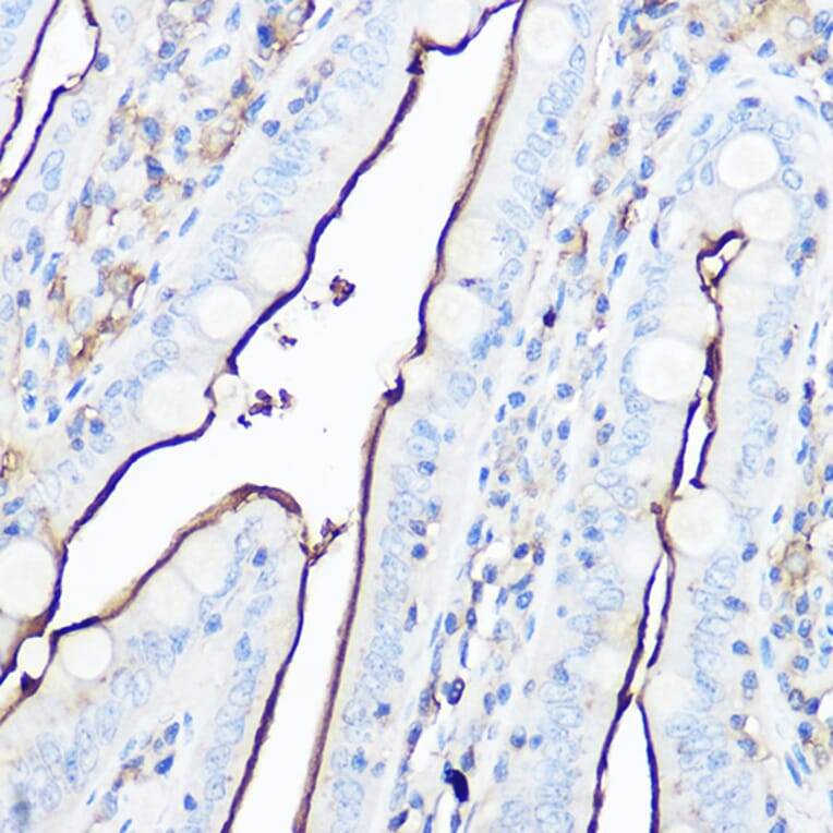 Immunohistochemistry - Anti-CD13 Antibody (A14890) - Antibodies.com