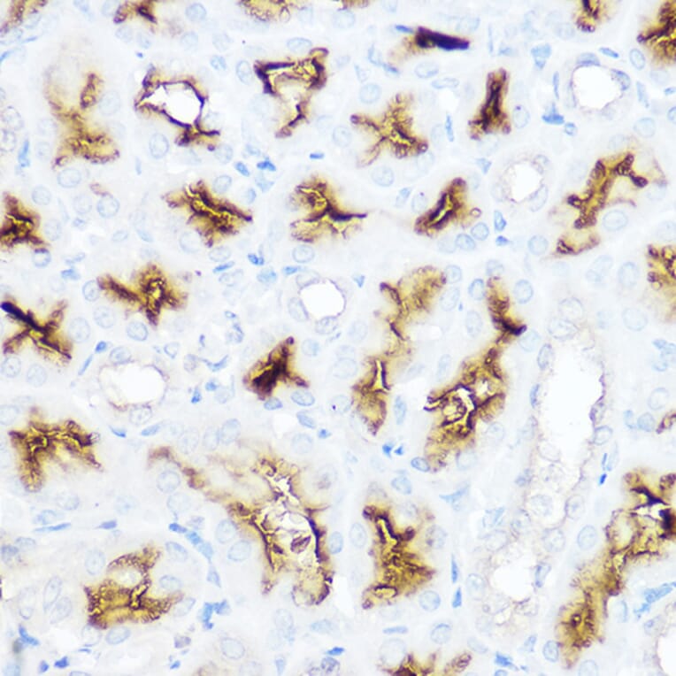 Immunohistochemistry - Anti-CD13 Antibody (A14890) - Antibodies.com