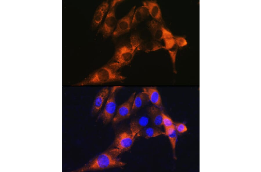Immunofluorescence - Anti-CD13 Antibody (A14890) - Antibodies.com