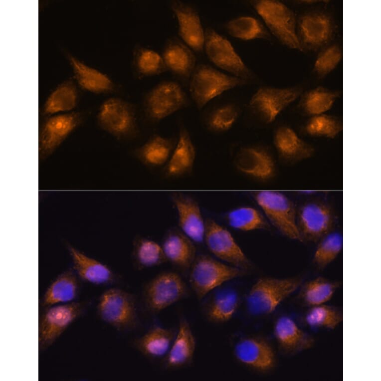 Immunofluorescence - Anti-CD13 Antibody (A14890) - Antibodies.com