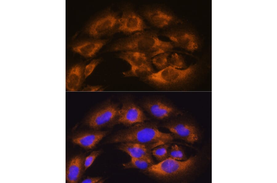 Immunofluorescence - Anti-CD13 Antibody (A14890) - Antibodies.com