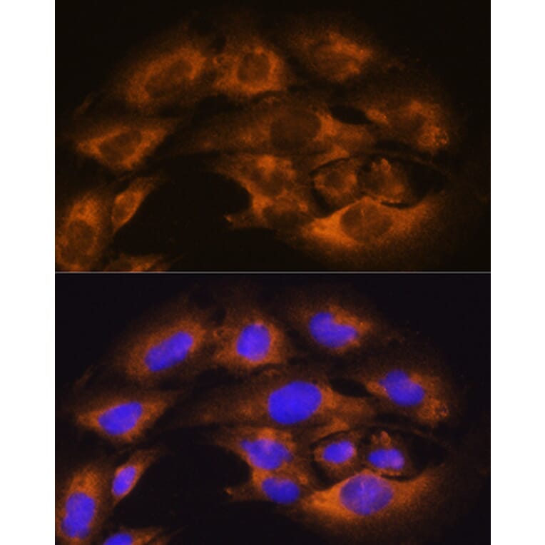 Immunofluorescence - Anti-CD13 Antibody (A14890) - Antibodies.com