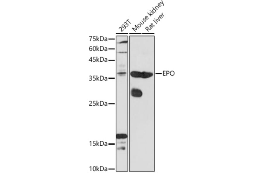 Western Blot - Anti-EPO Antibody (A14891) - Antibodies.com